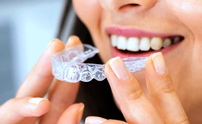 5 Easy Tips to Clean Stained Invisalign Trays | Annapolis