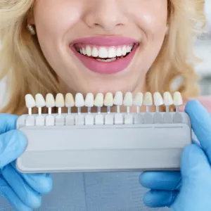 Veneers in Annapolis shade matching for a smiling patient during cosmetic dental treatment.