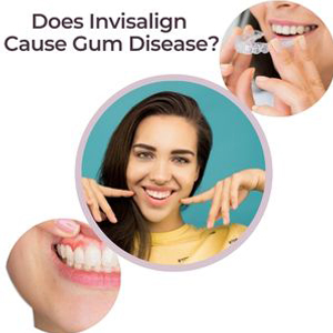 Does Invisalign Cause Gum Disease?