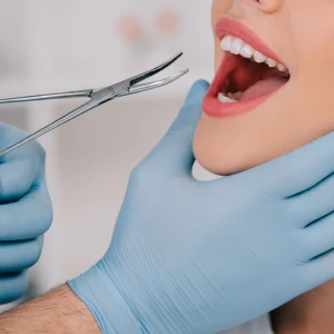 Patient receiving tooth extraction in Annapolis with professional dental care