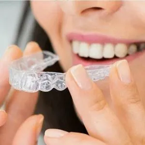 Your Step-by-Step Smile Solution to Invisalign in Annapolis