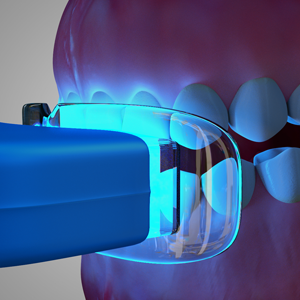 Teeth Whitening in Annapolis Teeth Whitening in Annapolis