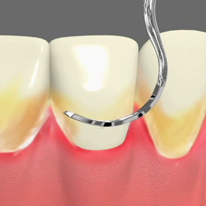 Periodontal Care Annapolis Periodontal Care