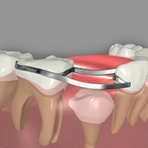 Preventive Dentistry