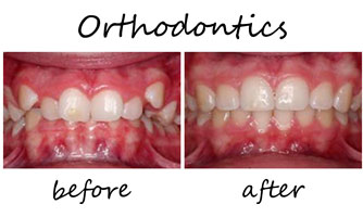 Orthodontics 2