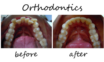 Orthodontics 5